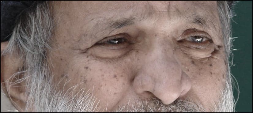 Edhi’s eyes to live after his life