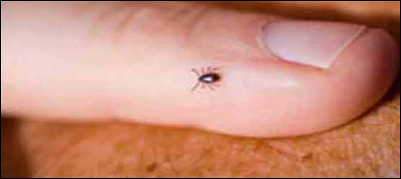 Fourth case of Congo virus reported in Karachi