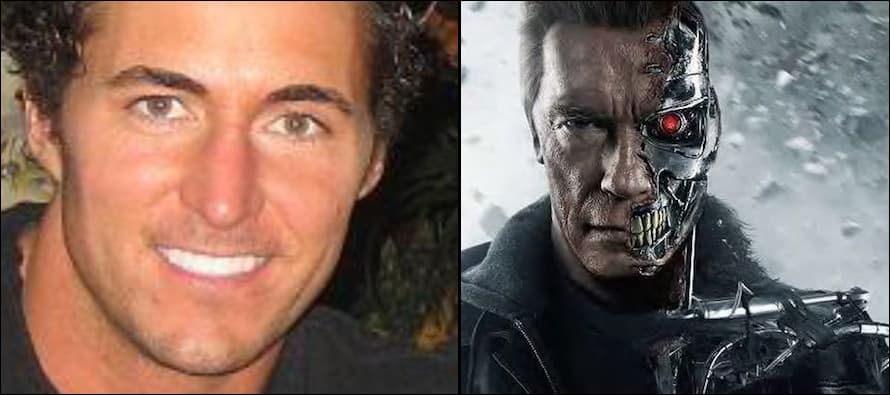 Man who lost half his face to cancer gets Terminator-style transplant
