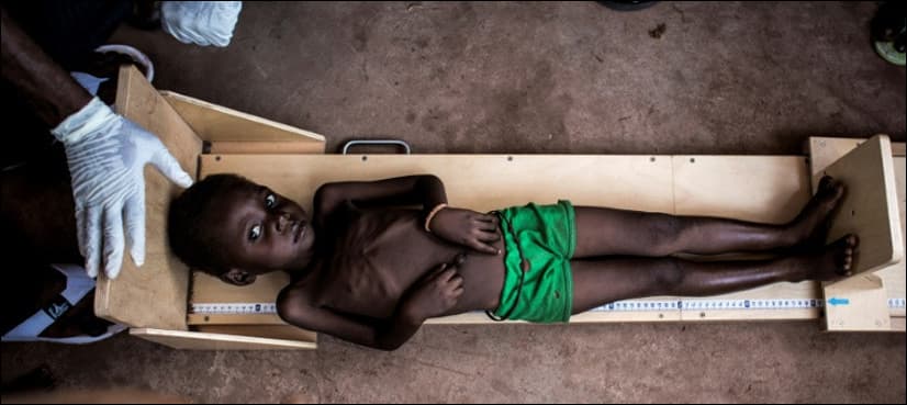 400,000 children in DR Congo could die from hunger, says Unicef