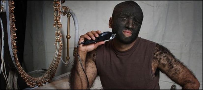 A real 'wolf man' has a message for people in his story