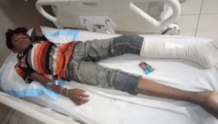 Another stray bullet incident leaves minor injured in Karachi