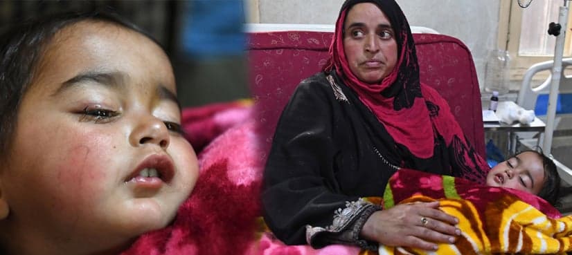 Doctors operate on child who became emblem of India’s use of pellet guns in Kashmir