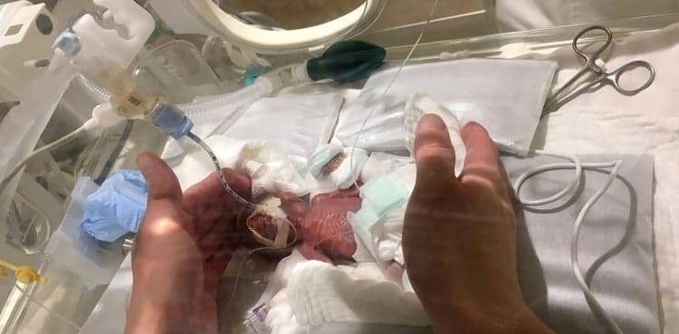 World's smallest newborn boy leaves hospital