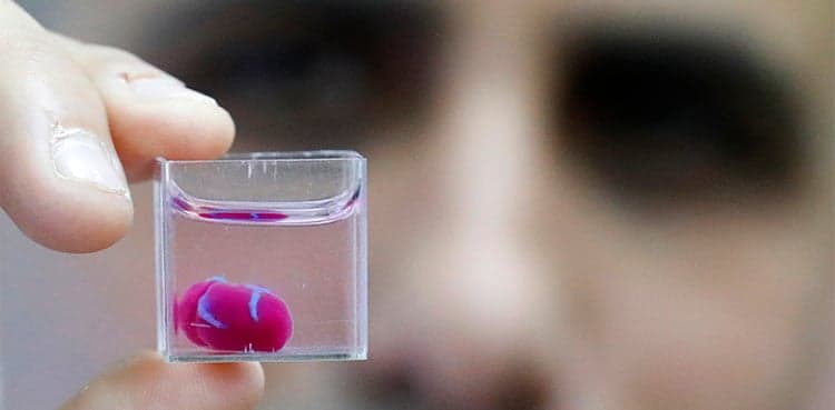 Arsenic exposure linked to heart thickening