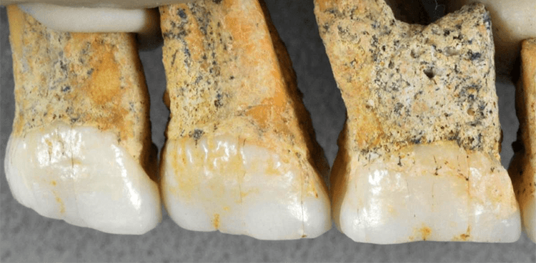 Fossils of previously unknown human species discovered in Philippines