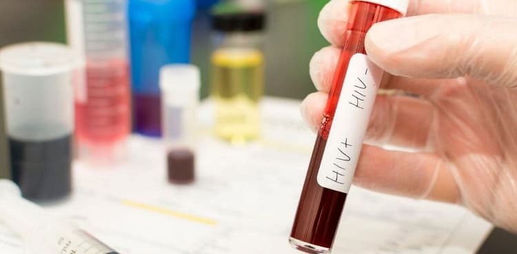 Five HIV positive cases surface in Thatta