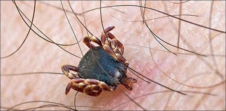 Congo Virus claimed three lives in Karachi last month: health officials