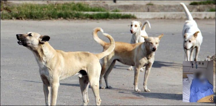 Woman dies owing to mad dog bite in Karachi