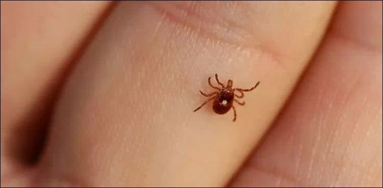 Congo virus patient dies at Karachi hospital