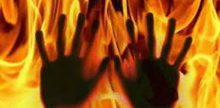 Young girl rescuing differently-abled father receives severe burns in Lahore  