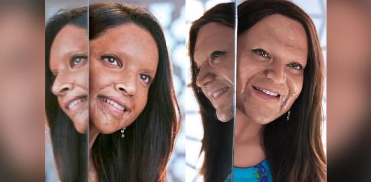 Pakistani makeup artist pays tribute to acid attack survivors