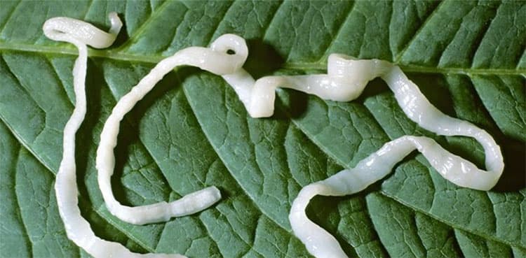WATCH: Tapeworm found in man's brain owing to food intake