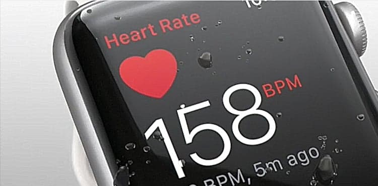 Study to find if Apple Watch app leads to lower stroke risk