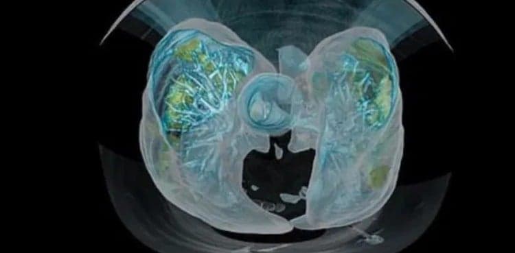 WATCH: Simulation shows how coronavirus causes harm with no visible symptoms