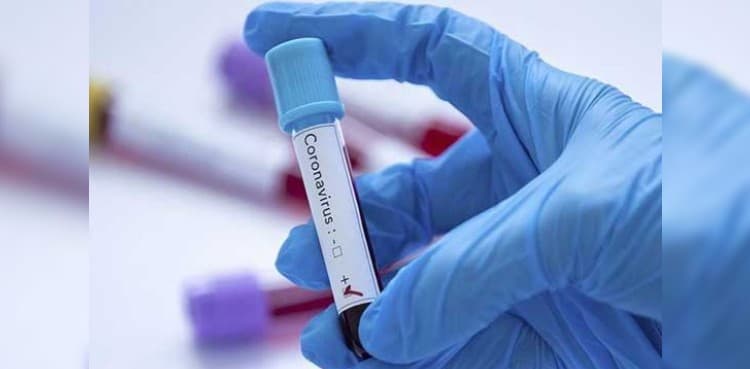 182 new coronavirus cases surface in Punjab, tally soars to 3,686