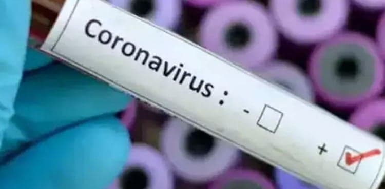 Alarm over large number of coronavirus cases among Afghan medics