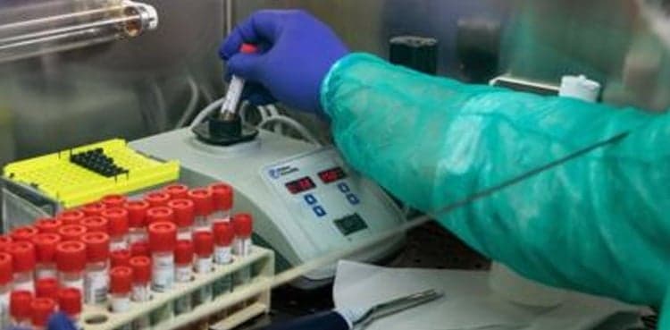 Balochistan hospital gets modern machinery for COVID-19 tests