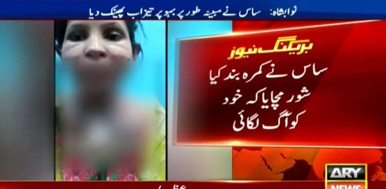 Husband, in-laws arrested over hurling acid, setting woman on fire