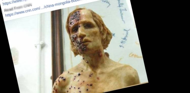 Has WHO issued epidemic warning over bubonic plague case in China?