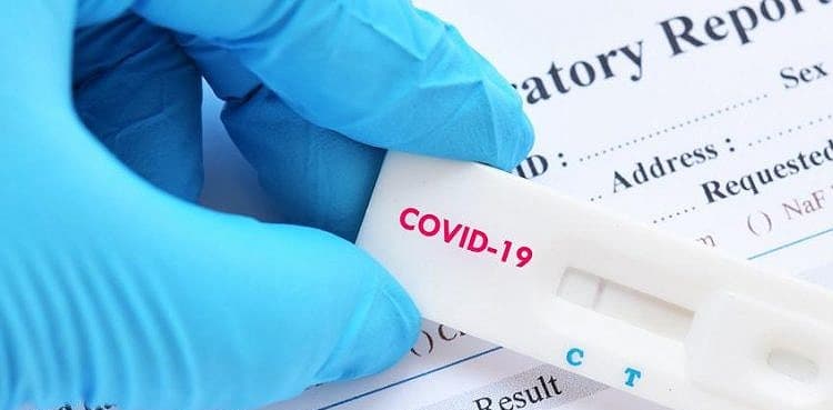Sindh notes 443 COVID-19 cases with more than half in Karachi
