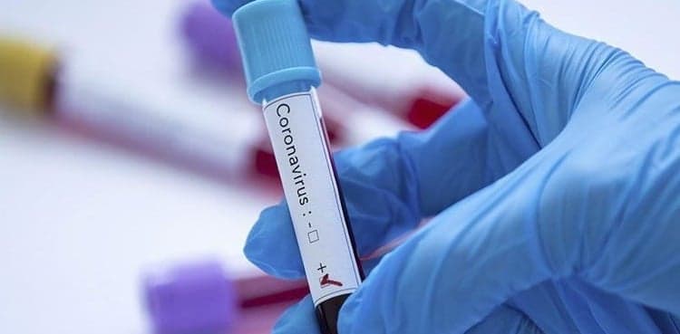 Balochistan records 21 fresh coronavirus cases