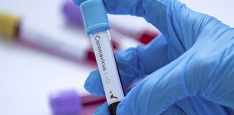 KP reports 384 new COVID-19 cases, eight deaths
