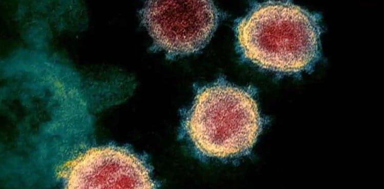 Coronavirus claims more 85 lives in Pakistan