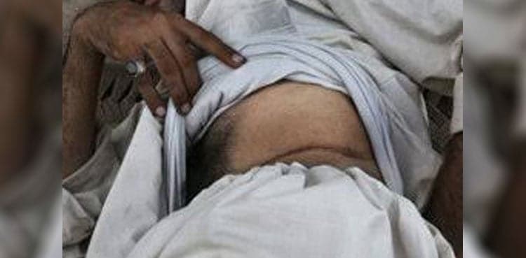 Four arrested including doctor in illegal kidney transplant racket