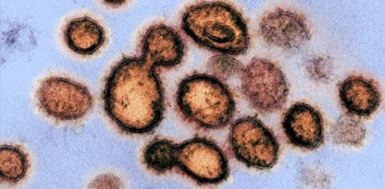 Virus mutations down to chance, in more ways than one