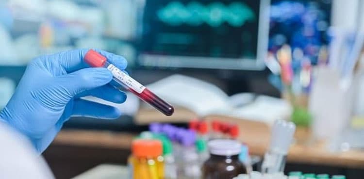 Second patient to be naturally cured of HIV brings hope to millions