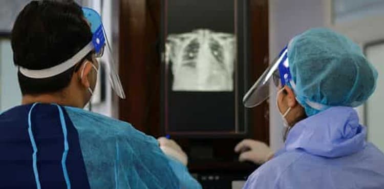 Lung transplant can save some COVID-19 survivors