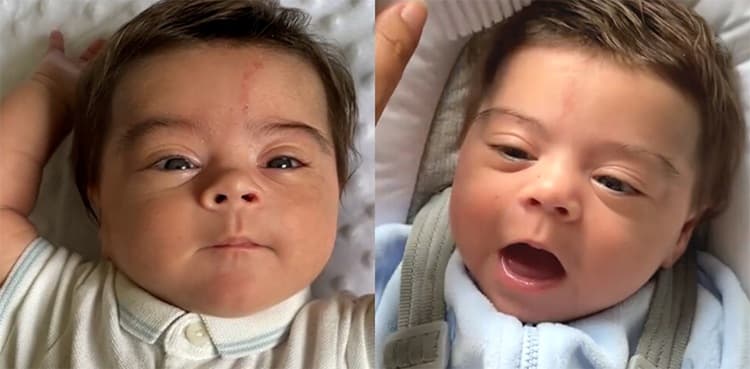 Newborn baby having thick hair on head goes viral
