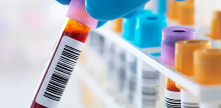 Oxford researchers develop blood test predictor of vaccine efficacy