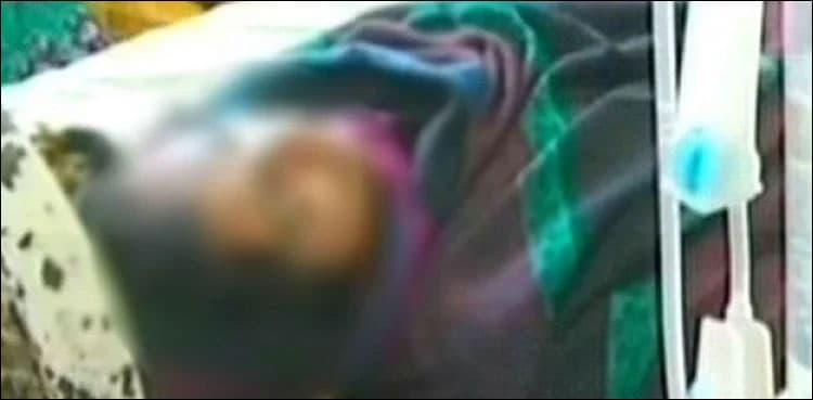 Punjab govt to bear medical expenses of Lahore acid attack victim