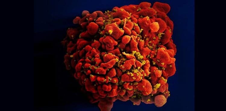 J&J's HIV vaccine fails in clinical trial