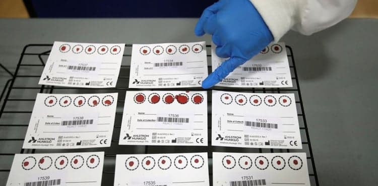 UK to begin offering COVID antibody testing to general public for first time