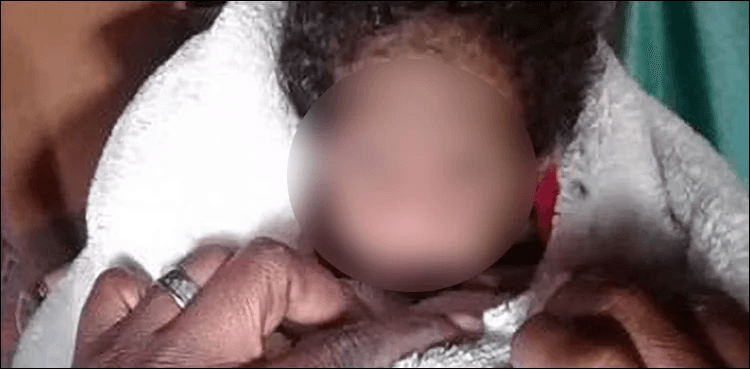Netizens make fun of baby with syndrome that affects body systems