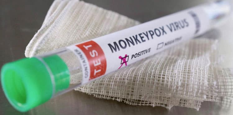 US preparing to deploy monkeypox vaccines amid more probable cases