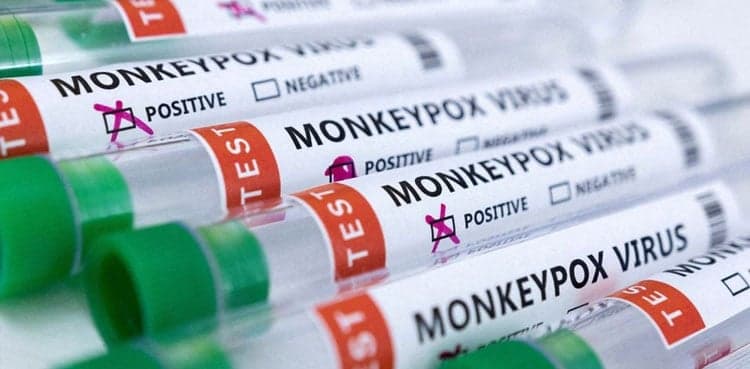 Pakistan’s last two monkeypox patients recover completely