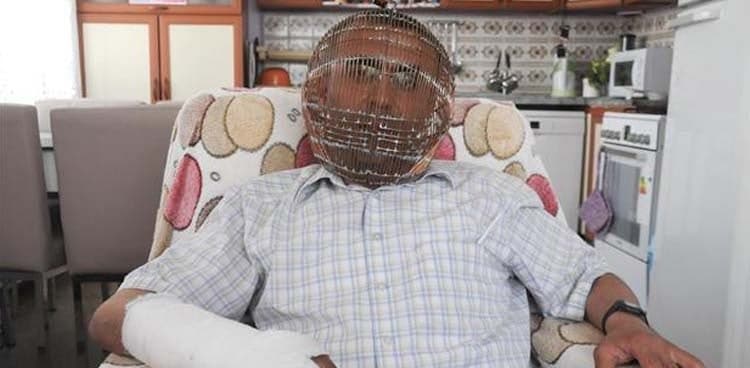 BIZARRE: Turkish Man locks his own head in a cage to quit smoking
