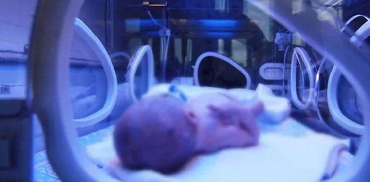 Infant suffers burns due to 'overheating' in incubator at Lahore's hospital