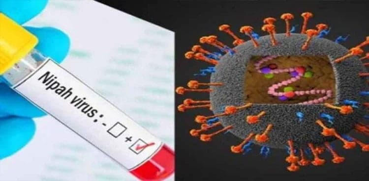 Sindh issues alert for Nipah virus