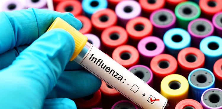 Influenza causing respiratory illness among people across Pakistan: NIH