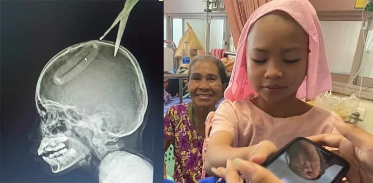 Boy throws, pierces sister's head with scissors while imitating movie fight scene