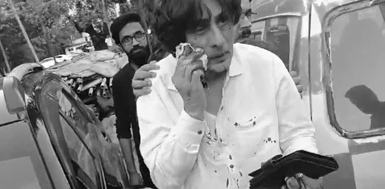 CCTV footage of attack on Raoof Hasan released