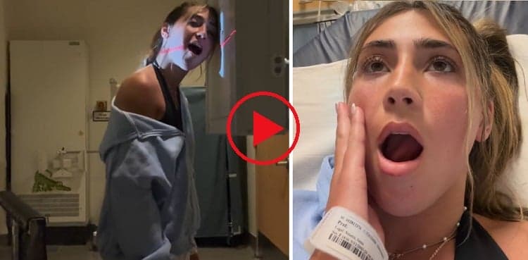 Yawn goes wrong: Influencer's jaw stuck wide open after yawning!