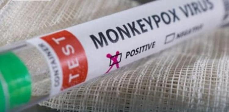 Passenger tests positive for Monkeypox at Karachi airport