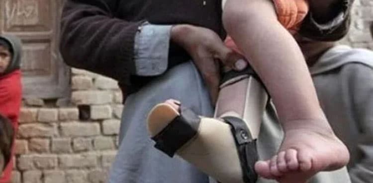 Pakistan 'reports' another polio case in 2025