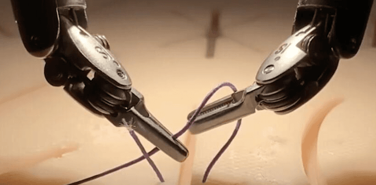 WATCH: AI trained robot mimic expert surgeons